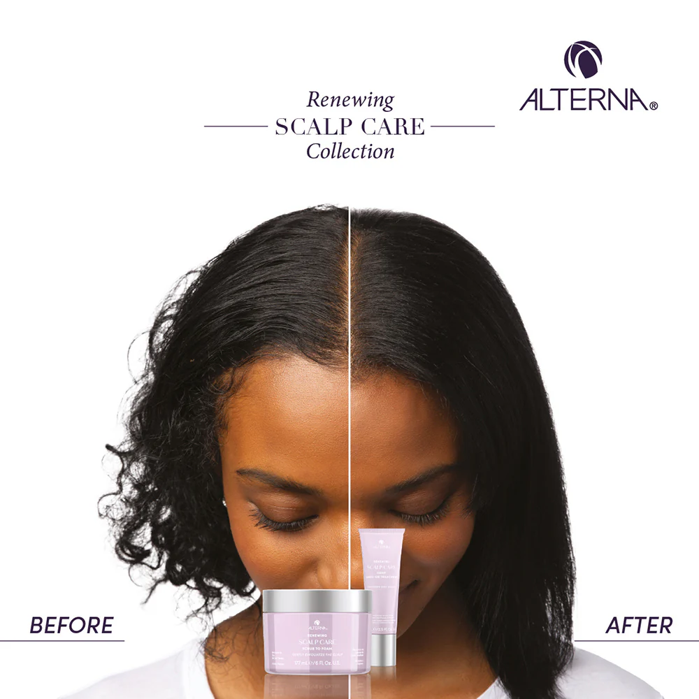 Renewing Scalp Care Scalp Scrub to Foam - 177ml - Image 4