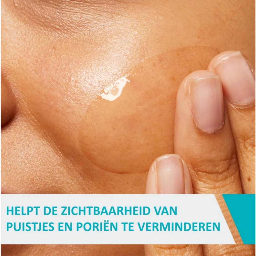 Blemisch Control Gel - 40ml - Image 3