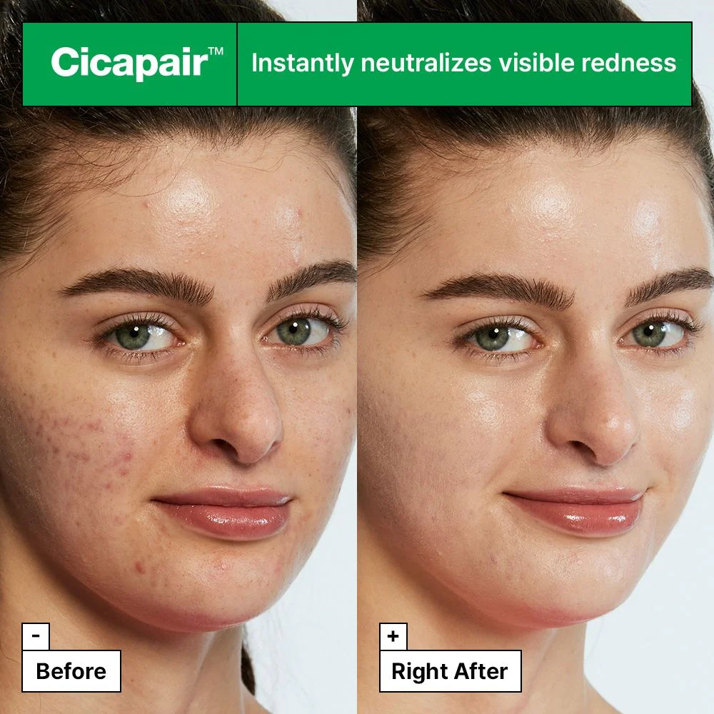Cicapair Tiger Grass Color Correcting Treatment - 30ml - Image 3
