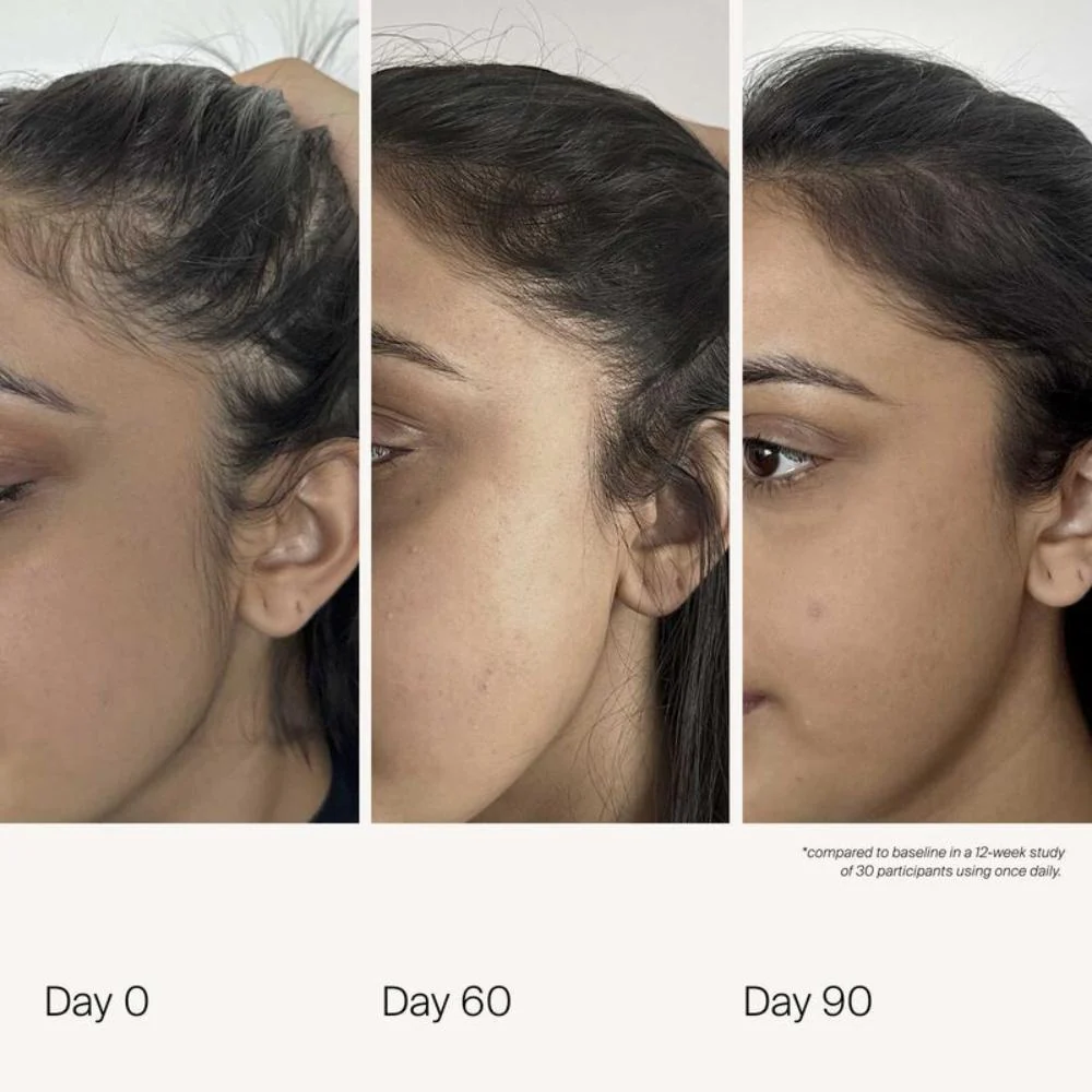 Scalp Care Density Serum - 50ml - Image 3