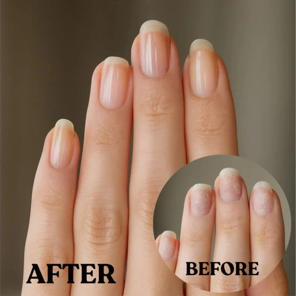 5-Day Recovery Treatment - 8ml - Image 3