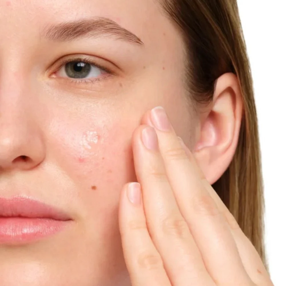 Salicylic Acid 2% Anhydrous Solution - 30ml - Image 3